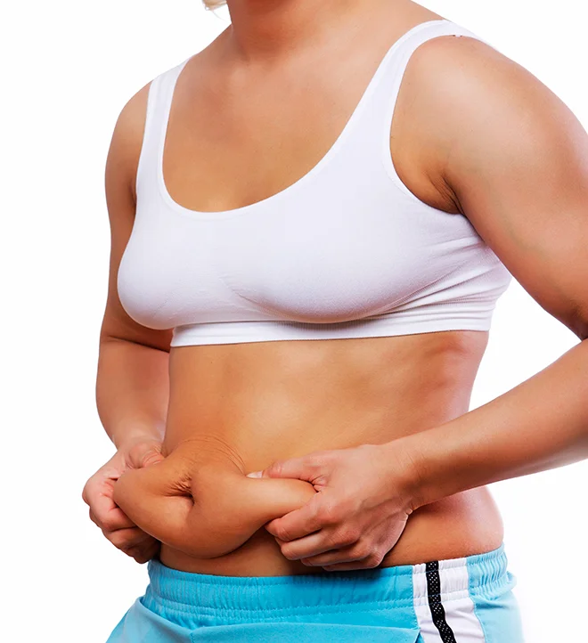 diastasis-abdominal2