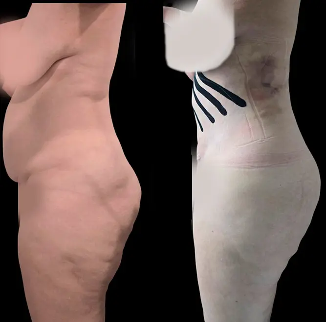 antes-despues